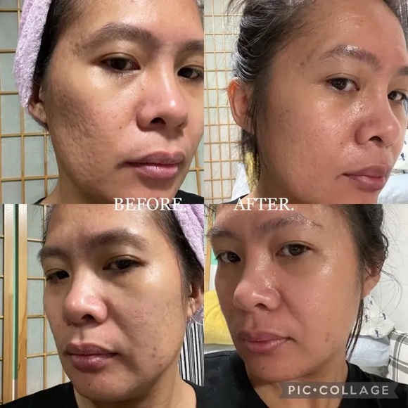 NWT 100 % authentic medicube device AG-R Booster H comes with 3 free samples - Picture 12 of 14